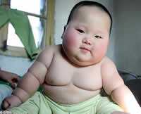 Obese-Infant. jpg