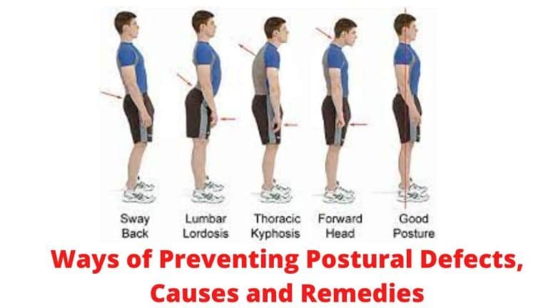 Postural Defects