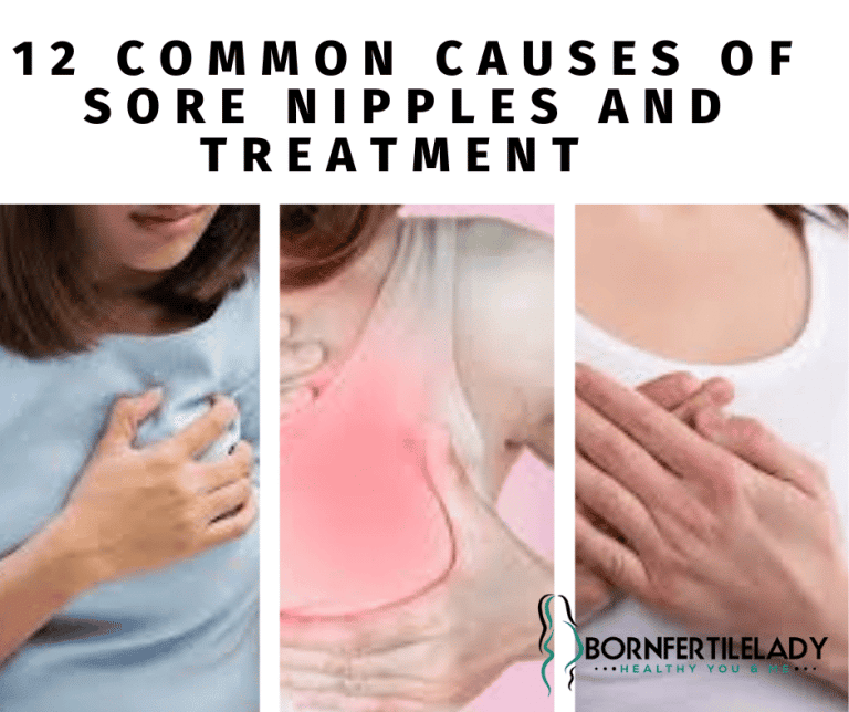 12 COMMON CAUSES OF SORE NIPPLES AND TREATMENT  1