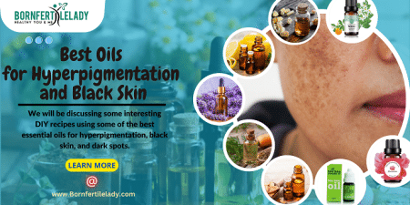 best oils for hyperpigmentation and black skin - Bornfertilelady.com