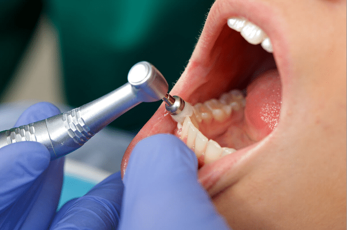 Why is my permanent tooth loose?: when is a loose tooth an emergency - Bornfertilelady