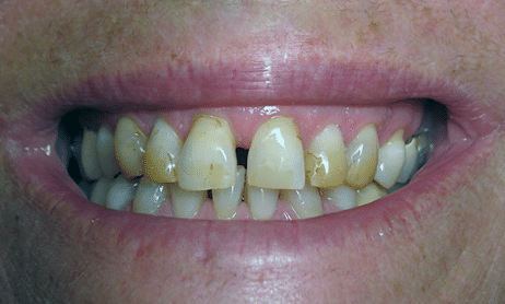 How to Keep Your Teeth Shining White Despite Drinking Caffeinated Drinks - Bornfertilelady.com